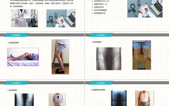 2022膝關節置換術后護理查房PPT商務簡約護理查房必備PPT