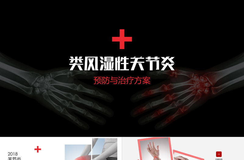 類風濕性關節(jié)炎醫(yī)藥醫(yī)療類PPT模板