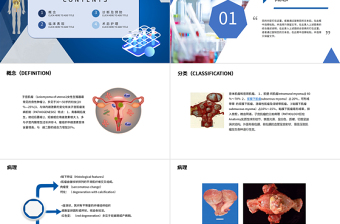 2022子宮肌瘤PPT醫(yī)療教學(xué)疾病醫(yī)理類通用PPT模板